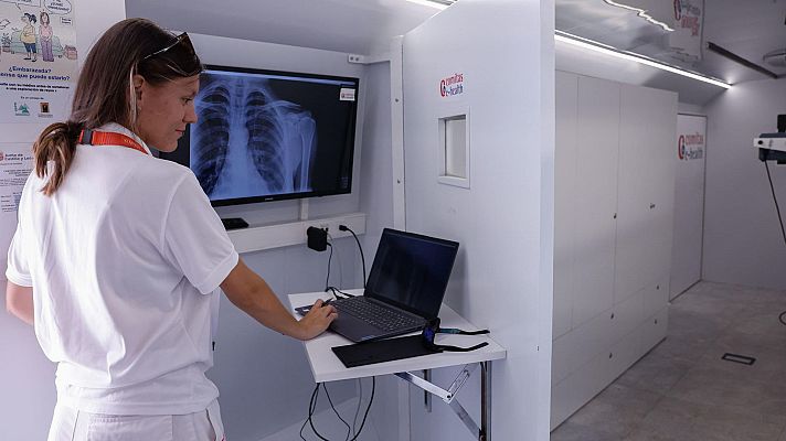 Telediario Fin de Semana - Así funciona la radiología, un servicio sanitario clave para la detección de enfermedades
