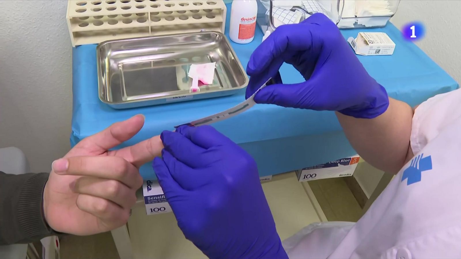 Un terç dels diagnòstics de VIH són tardans