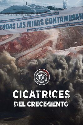 Documentos TV - Cicatrices del crecimiento