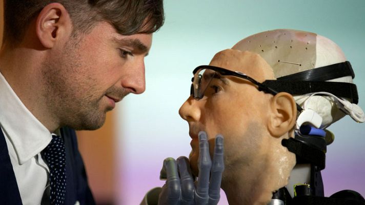 Telediario 1 - Rex, el primer hombre biónico