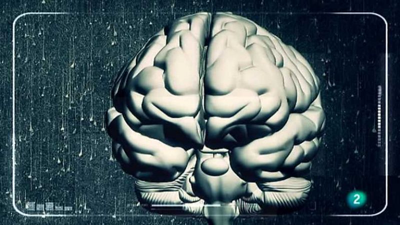 I + - Alzheimer - Ver ahora 