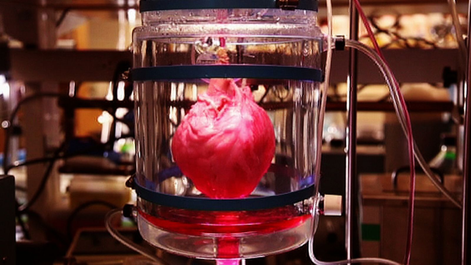 La noche temática: El corazón autosuficiente - Avance | RTVE Play