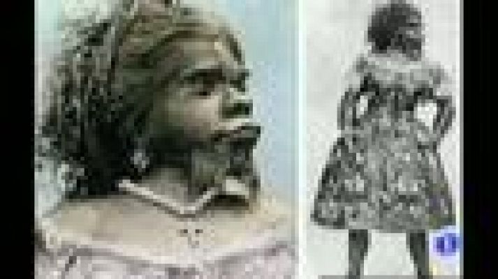 Telediario 1 - Enterrada en México la "mujer mono"