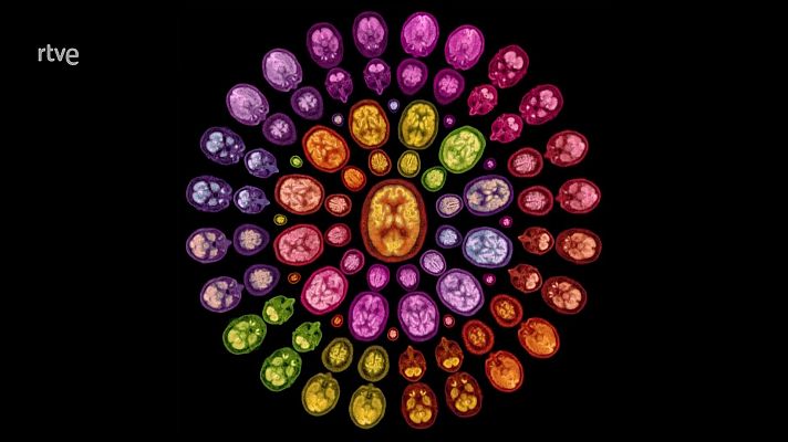 La aventura del Saber - Proyecto de Arte en el Hospital Gregorio Marañón