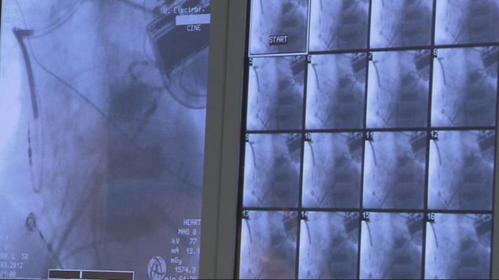 Telediario 1 - Día Mundia de las Cardiopatías