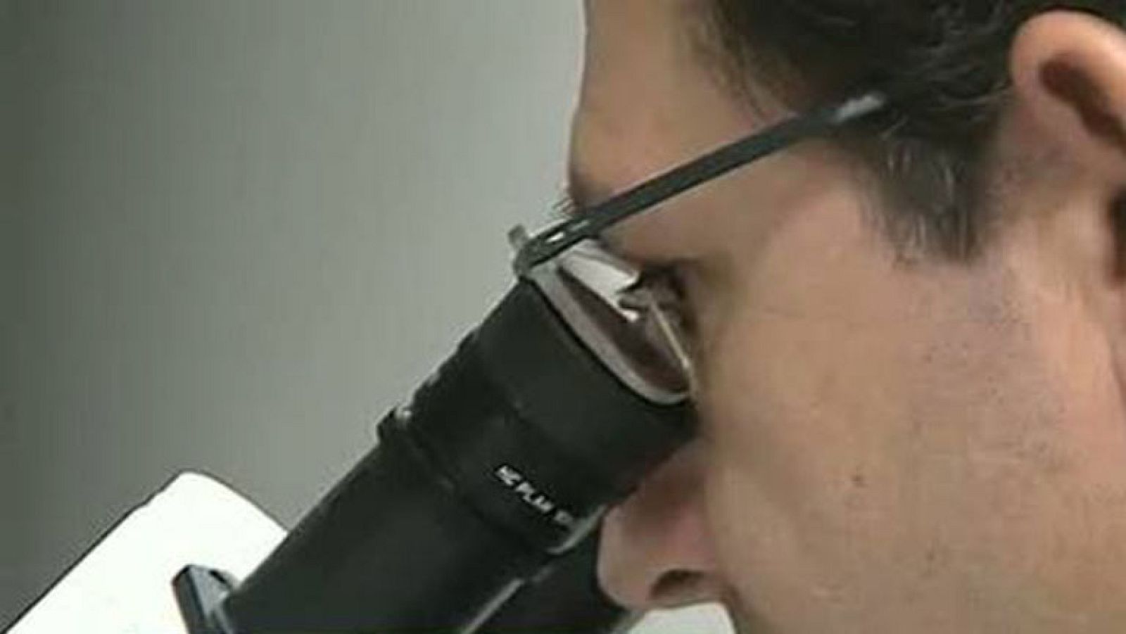 Un equipo del Instituto de Investigación Biomédica de Barcelona ha descifrado un nuevo mecanismo en la regulación de los genes de las células tumorales. Se trata de una proteína que sería la responsable del desarrollo descontrolado de las células cancerígenas.Esta nueva diana terapeútica permitirá diseñar fármacos más eficaces. No perjudicarán a las células sanas y por tanto tendrán menos efectos secundarios. 