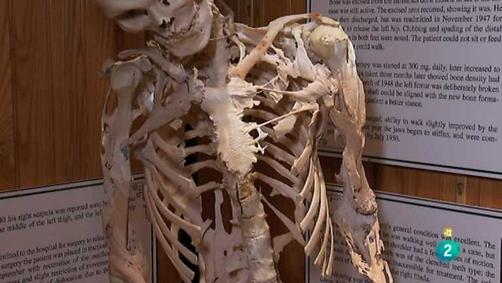 La noche temática - Unos huesos extraordinarios - Ver ahora