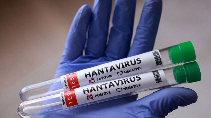Qué se sabe del hantavirus de la cepa de los Andes | Ver