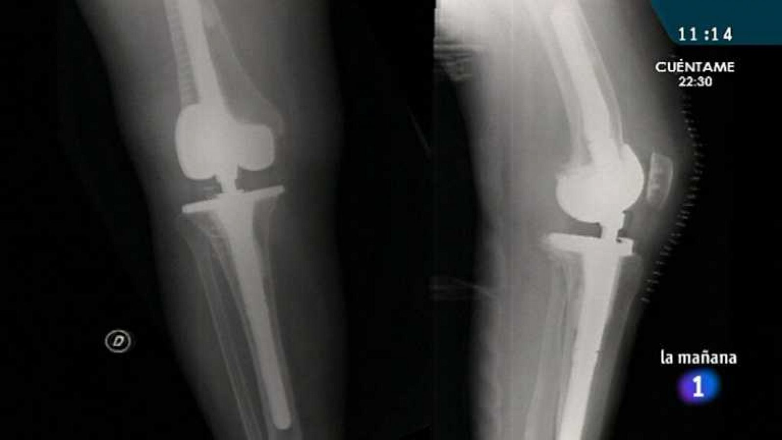 La aventura del saber - 18/04/13 - ver ahora