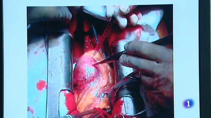 L'informatiu - Comunitat Valenciana - L'Informatiu - Comunitat Valenciana 2 - 24/04/13