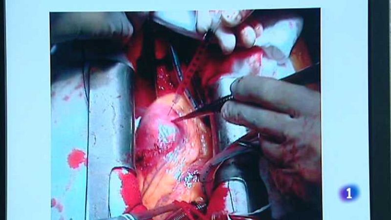 L'Informatiu - Comunitat Valenciana 2 - 24/04/13 - Ver ahora 