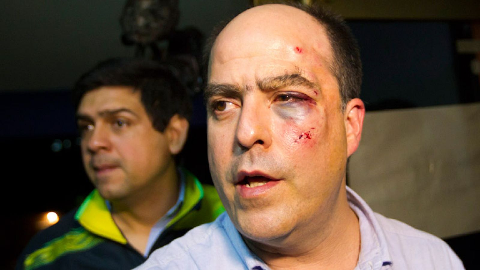 Diputados opositores se enfrentan a golpes en la Asamblea Nacional de Venezuela