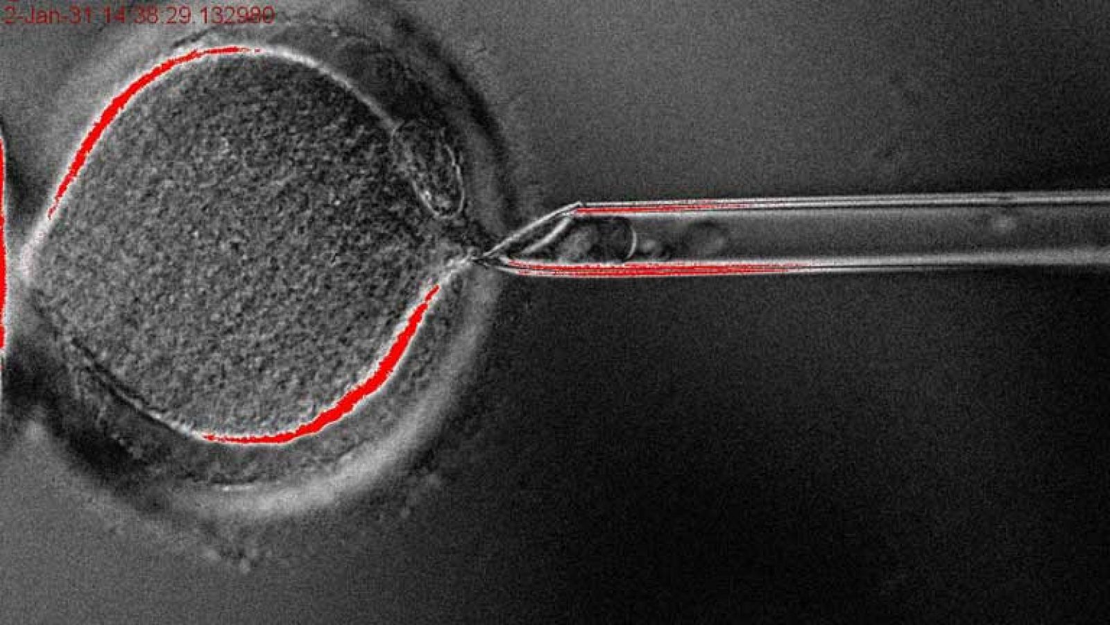 Telediario 1: Clonación de celulas madre | RTVE Play