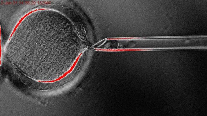 Clonación de celulas madre