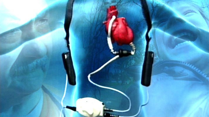 Documentos TV - Corazones artificiales - Avance