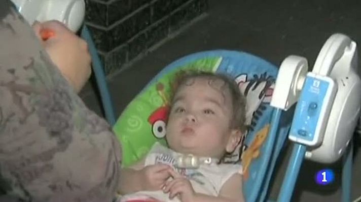 Telediario 1 - Una tráquea hecha con una impresora 3D salva la vida de un bebé