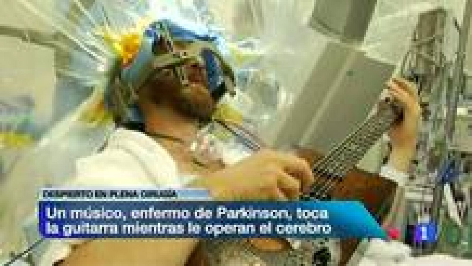 Le operan el cerebro a un músico mientras toca su guitarra | Ver