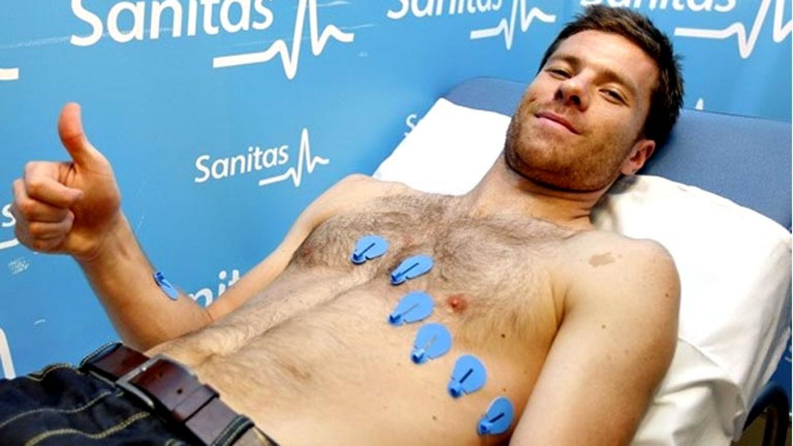 Xabi Alonso, centrocampista del Real Madrid, fue intervenido con éxito de una pubalgia que le impidió concentrarse con la selección española de fútbol para participar en la Copa Confederaciones que se disputará en Brasil en el mes de junio.