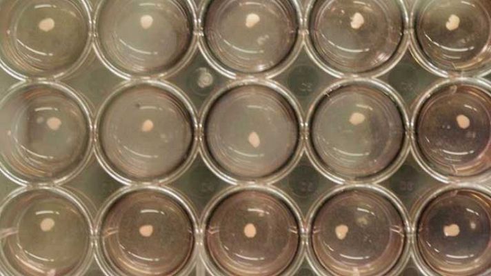 Telediario 1 - Hígado a partir de células madre