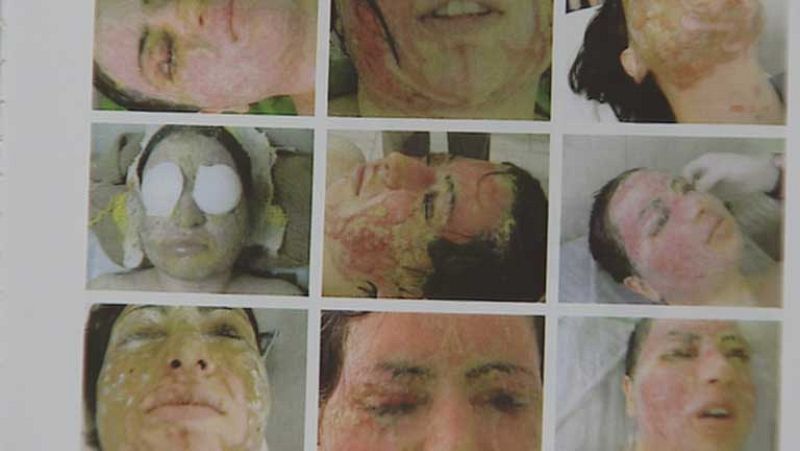 India exige regular la venta de ácido ante los ataques a mujeres