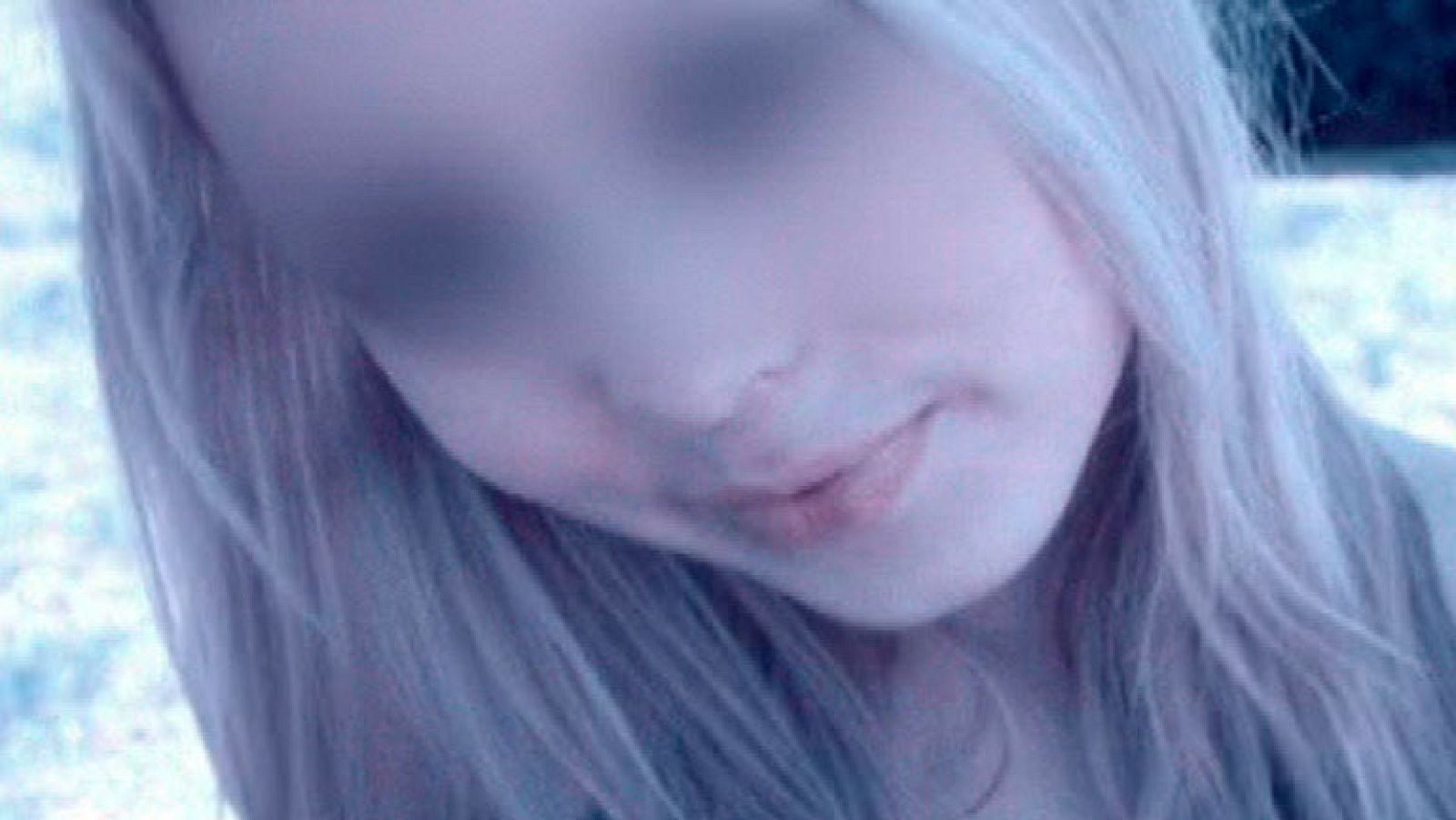 España Directo- Una menor pierde un ojo tras una agresión