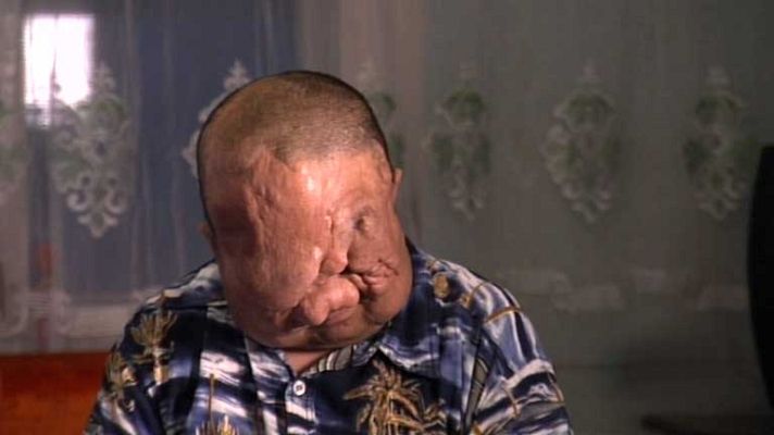 En portada - Hijos de la guerra atómica - Avance