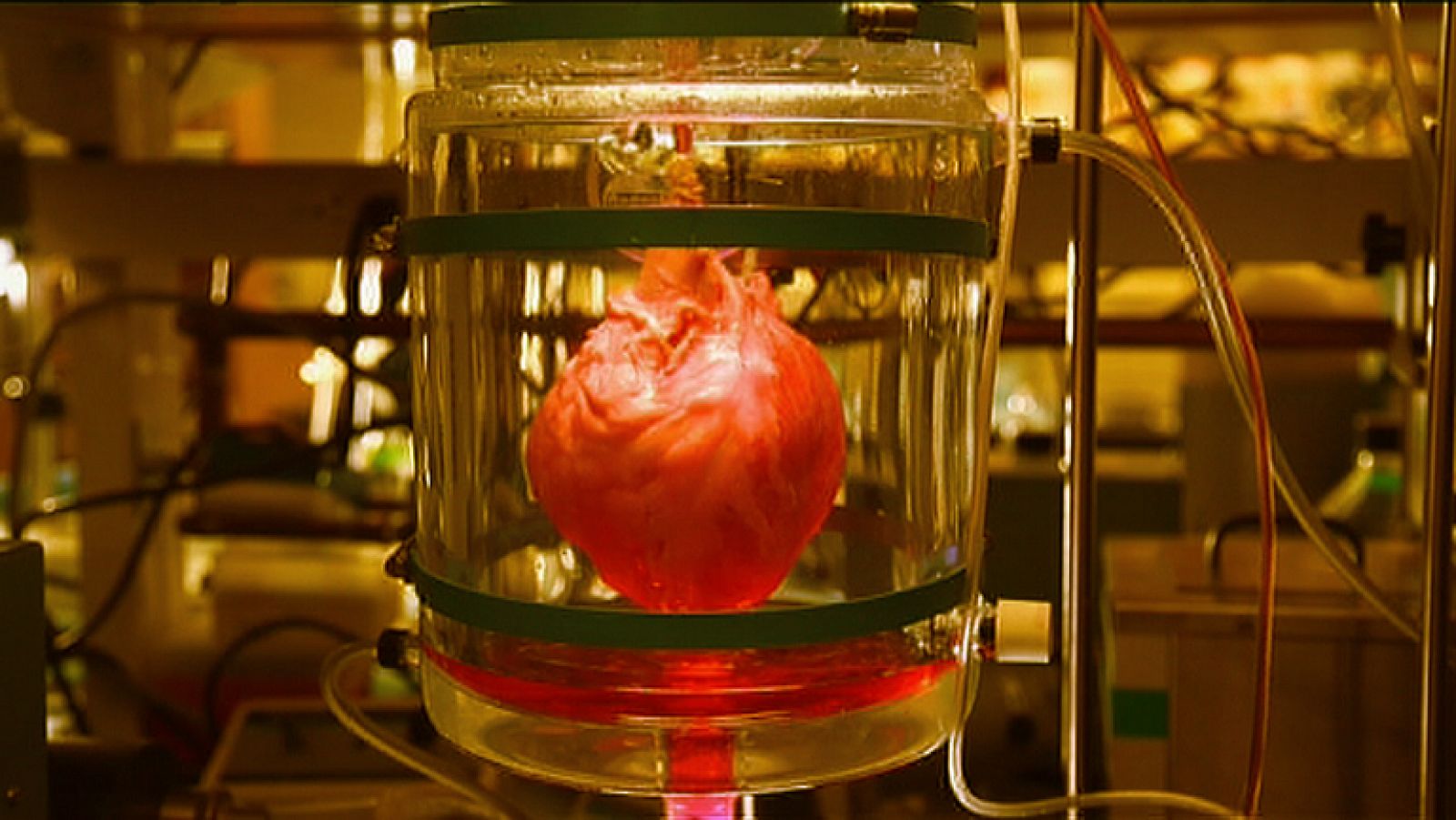 La Noche Temática - El corazón autosuficiente - Avance - La noche temática | Ver