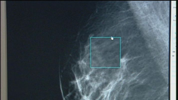 Telecanarias - Telecanarias - 19/10/13