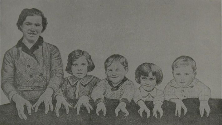 Documentos TV - Higiene racial - Comienzo