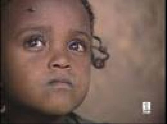 Etiopía, retrato del hambre