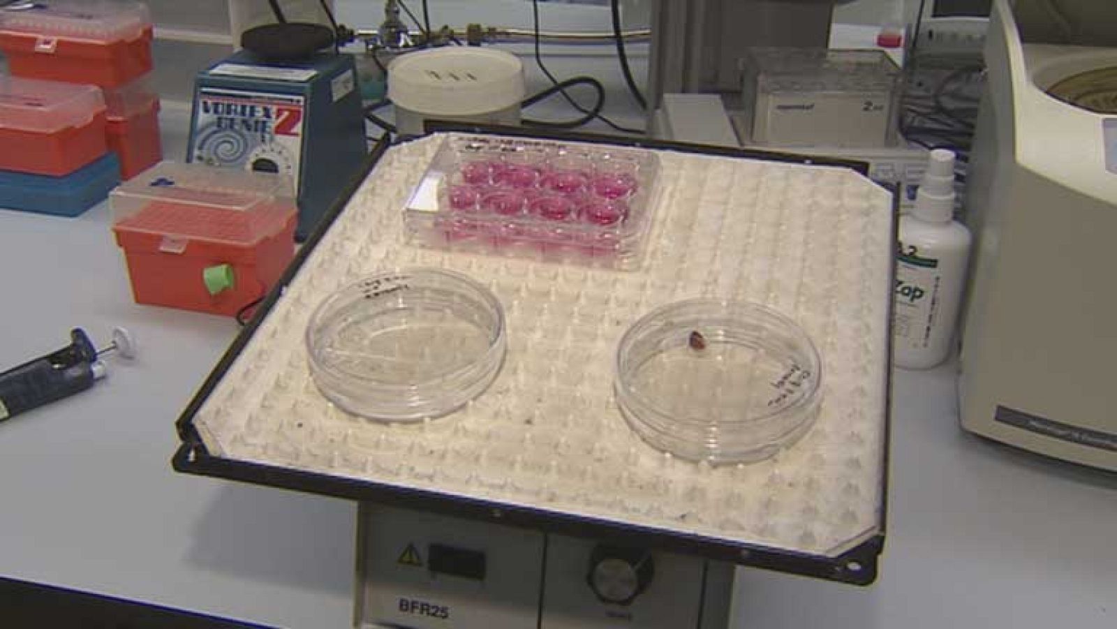 El Centro de Medicina Regenerativa de Barcelona ha creado por primera vez "mini riñones"