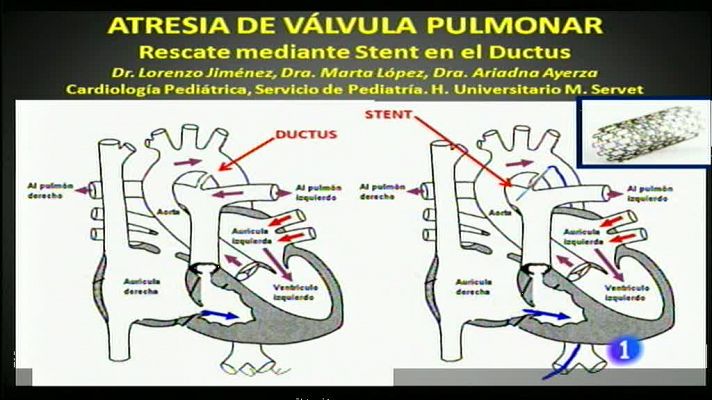 Noticias Aragón - Noticias Aragón 2 - 25/11/13
