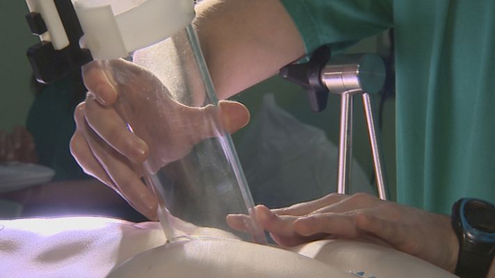 Telediario 1 - El Hospital Gregorio Marañón estrena el primer quirófano del mundo con navegador