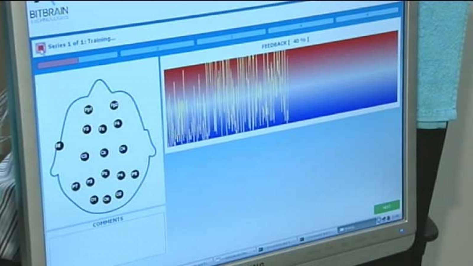 Telediario 1: Test neurológico | RTVE Play