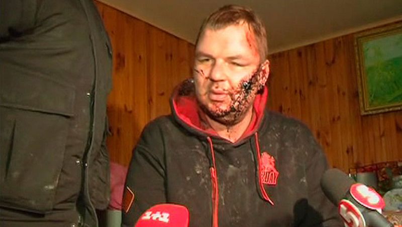 Reaparece con signos de tortura el opositor ucraniano Dimitry Bulatov - Informativo 24h | Ver