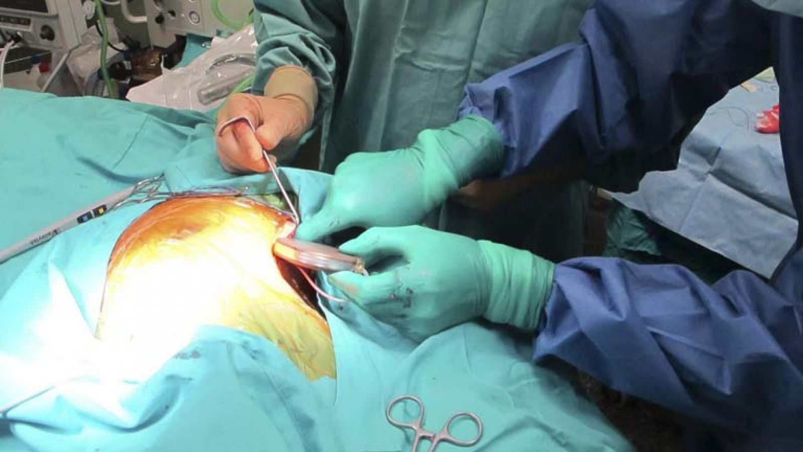 Telediario 1: Intervención quirúrgica médicos Vall d'Hebrón | RTVE Play