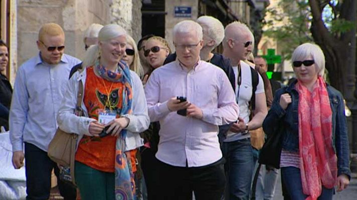 Telediario 1 - Valencia se convierte en la capital europea del albinismo