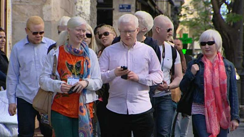 Valencia se convierte por unos días en la capital europea del albinismo