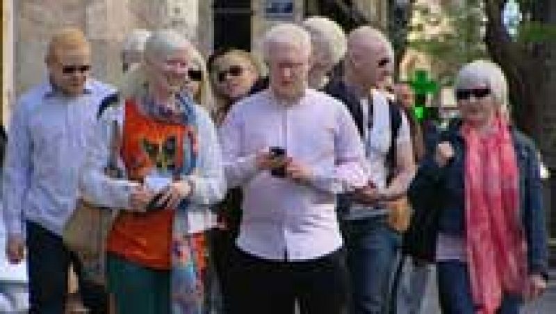 Valencia se convierte por unos días en la capital europea del albinismo