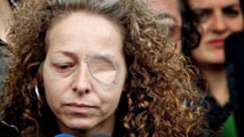 El juez ve imprudente la acción de los mossos que hizo perder un ojo a una mujer