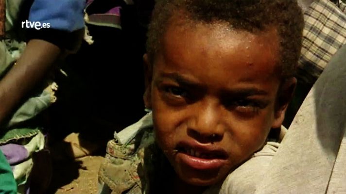 Etiopía, todas las caras del hambre