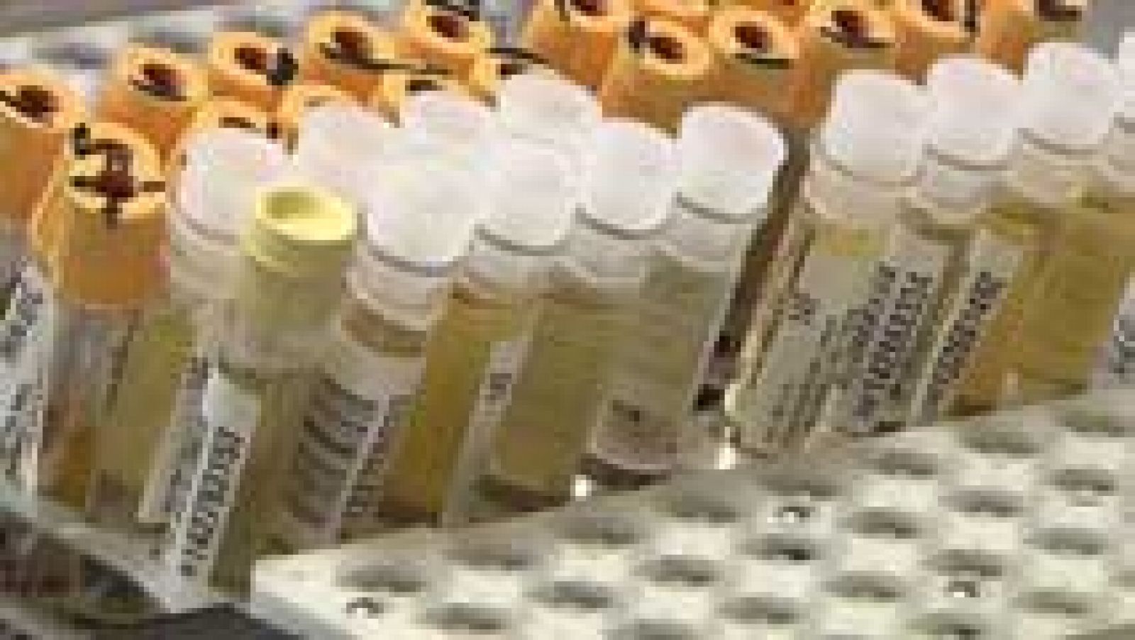 Cada año se detectan 25.000 nuevos casos de cáncer de próstata