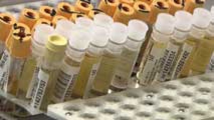 Telediario 1 - 25.000 nuevos casos de cáncer de próstata al año