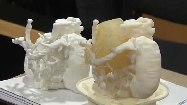 Telediario 1 - Modelo 3D de un tumor