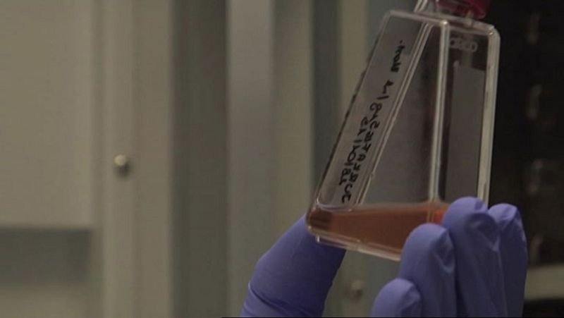 Un gel podría ser la solución a la infección vía sexual del VIH, el virus del Sida.