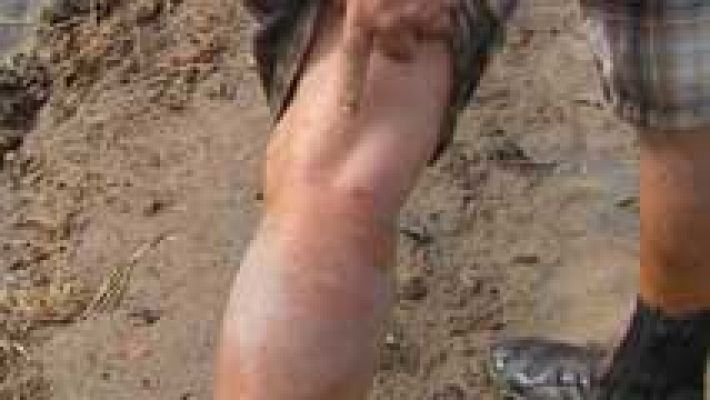 Telediario 1 - En verano llegan a muchos lugares las plagas de mosquitos