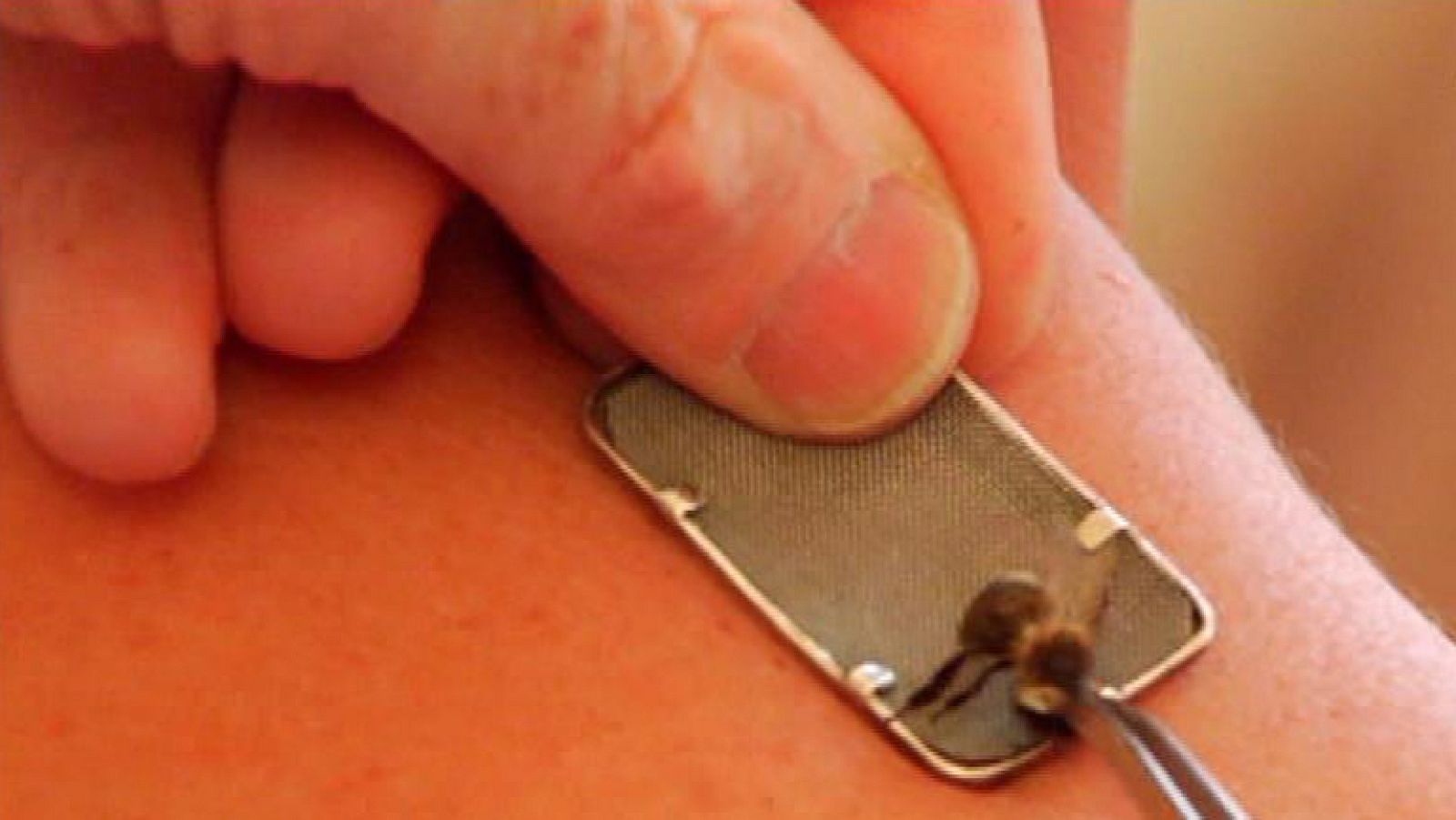 ¿Veneno de abeja bueno para la salud? No lo probéis en casa