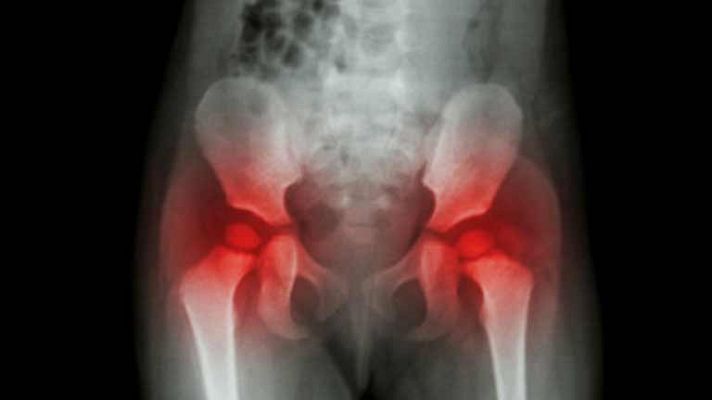 La mañana - Rodilla y cadera