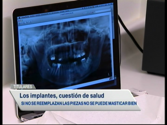 Informativo Telerioja - Informativo Telerioja 2 - 11/09/14