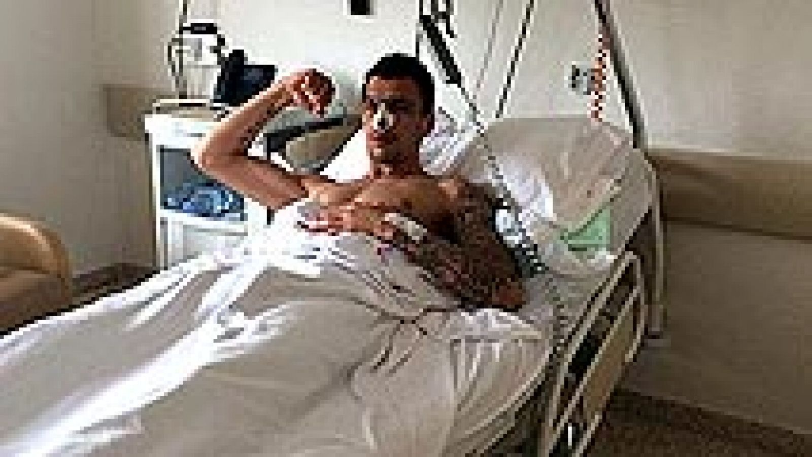 El delantero croata del Atlético de Madrid Mario Mandzukic ha sido operado con éxito de la fractura nasal que sufrió el martes en el partido contra el Olympiacos griego correspondiente a la Liga de Campeones, según ha informado el club rojiblanco en 